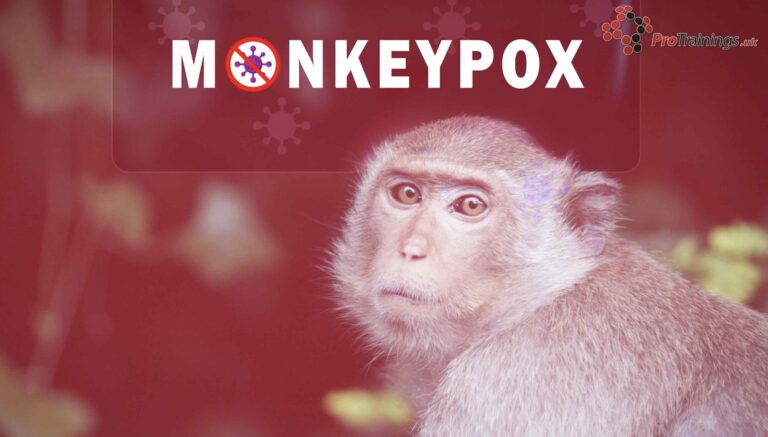 Monkeypox